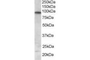 Image no. 1 for anti-Forkhead Box O3 (FOXO3) (C-Term) antibody (ABIN374440)