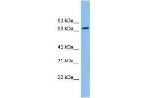 WB Suggested Anti-ZNF182 Antibody Titration: 0. (ZNF182 抗体  (Middle Region))