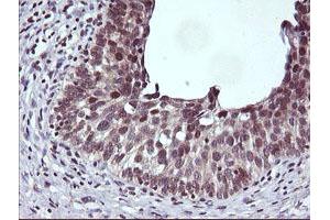 Image no. 1 for anti-Cancer/testis Antigen 1B (CTAG1B) antibody (ABIN1499894) (CTAG1B 抗体)