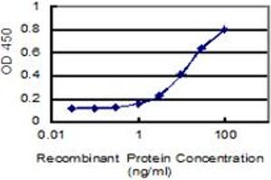 Detection limit for recombinant GST tagged KIAA1217 is 0. (ETL4 抗体  (AA 1-877))