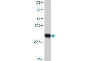 Western Blot detection against Immunogen (37. (LOXL3 抗体  (AA 171-270))