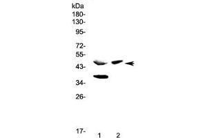 Western blot testing of 1) rat pancreas and 2) mouse pancreas lysate with Carboxypeptidase A antibody at 0. (CPA 抗体)