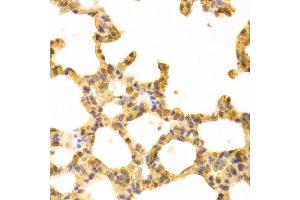 Immunohistochemistry of paraffin-embedded rat lung using UBE2I antibody at dilution of 1:100 (x400 lens).