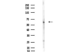 Western blot analysis of lysates from LoVo cells(heat-shock,45 min treatment), using ZNF530 Antibody at 1/1000 dilution.