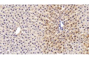 Immunohistochemistry (IHC) image for anti-Alanine Aminotransferase (ALT) (AA 147-263) antibody (ABIN7438472)