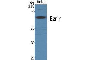 Western Blot (WB) analysis of specific cells using Ezrin Polyclonal Antibody. (Ezrin 抗体  (Tyr315))
