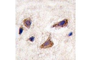 IHC analysis of FFPE human brain tissue stained with CAMKK2 antibody (CAMKK2 抗体  (AA 483-512))