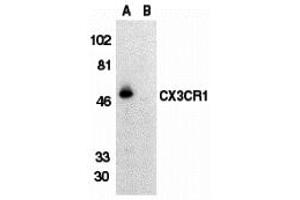 Western Blotting (WB) image for anti-Chemokine (C-X3-C Motif) Receptor 1 (CX3CR1) (Extracellular Loop) antibody (ABIN1030840) (CX3CR1 抗体  (Extracellular Loop))