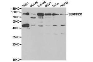 Western Blotting (WB) image for anti-Serpin Peptidase Inhibitor, Clade G (C1 Inhibitor), Member 1 (SERPING1) antibody (ABIN1874741) (SERPING1 抗体)
