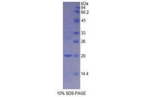 SDS-PAGE (SDS) image for Nitric Oxide Synthase 1, Neuronal (NOS1) (AA 726-894) protein (His tag) (ABIN1879092)