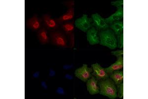 MKK3/MKK6 Antibody staining A549 cells by IF/ICC.