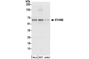Western Blotting (WB) image for anti-Signal Transducing Adaptor Molecule (SH3 Domain and ITAM Motif) 2 (STAM2) (AA 175-225) antibody (ABIN7450780)