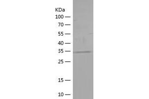 Western Blotting (WB) image for Ataxin 2 (ATXN2) (AA 1-165) protein (His tag) (ABIN7282080) (Ataxin 2 Protein (ATXN2) (AA 1-165) (His tag))