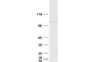 Validation with Western Blot (Tumor Protein p73 Protein (Transcript Variant 1) (Myc-DYKDDDDK Tag))