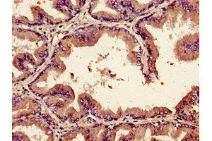 Immunohistochemistry of paraffin-embedded human prostate tissue using ABIN7145684 at dilution of 1:100 (BMP2 抗体  (AA 283-396))