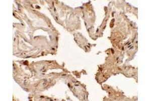 Immunohistochemistry of NKX2-1 in human lung tissue with NKX2-1 antibody at 2. (NKX2-1 抗体  (N-Term))