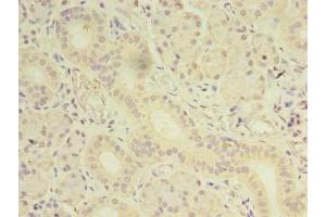Immunohistochemistry of paraffin-embedded human pancreatic tissue using ABIN7165891 at dilution of 1:100 (OSR2 抗体  (AA 101-276))