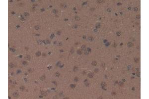 DAB staining on IHC-P; Samples: Rat Brain Tissue (Orexin A 抗体  (AA 32-123))