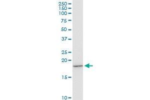 EIF1AY monoclonal antibody (M01), clone 1B4. (EIF1AY 抗体  (AA 22-95))