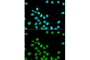 Immunofluorescence analysis of HeLa cells using Lamin A/C antibody. (Lamin A/C 抗体)
