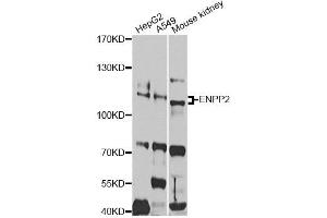 Western blot analysis of extracts of various cell lines, using ENPP2 antibody. (ENPP2 抗体)