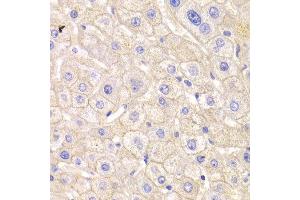 Immunohistochemistry (IHC) image for anti-Catenin (Cadherin-Associated Protein), delta 1 (CTNND1) (AA 573-832) antibody (ABIN3022309)