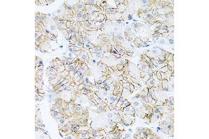 Immunohistochemistry of paraffin-embedded human stomach using IL17A antibody at dilution of 1:100 (x40 lens). (Interleukin 17a 抗体)