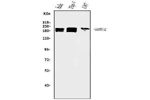 Western blot analysis of SMARCA2/BRM using anti-SMARCA2/BRM antibody (ABIN7600365).