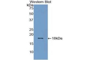 Detection of Recombinant BMP15, Rat using Polyclonal Antibody to Bone Morphogenetic Protein 15 (BMP15) (BMP15 抗体  (AA 269-391))