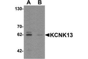 Western blot analysis of KCNK13 in rat brain tissue lysate with KCNK13 Antibody  at 0. (KCNK13 抗体  (Middle Region))