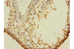 Immunohistochemistry (IHC) image for anti-Ankyrin Repeat, SAM and Basic Leucine Zipper Domain Containing 1 (ASZ1) (AA 1-200) antibody (ABIN7144247)