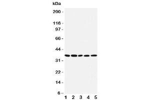 Western blot testing of IRF1 antibody and Lane 1:  COLO320