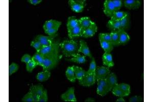 Immunofluorescence staining of HepG2 cells with ABIN7151078 at 1:100, counter-stained with DAPI. (NEDD4-2 抗体  (AA 289-494))