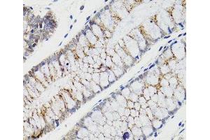 Immunohistochemistry of paraffin-embedded Human rectum using CHMP4B Polyclonal Antibody at dilution of 1:100 (40x lens). (CHMP4B 抗体)