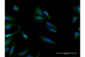 Immunofluorescence of purified MaxPab antibody to CALCB on HeLa cell.