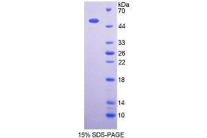 SDS-PAGE analysis of Human OXCT1 Protein. (OXCT1 蛋白)