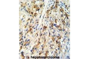 Immunohistochemistry (IHC) image for anti-Cat Eye Syndrome Chromosome Region, Candidate 5 (CECR5) antibody (ABIN3003803) (CECR5 抗体)