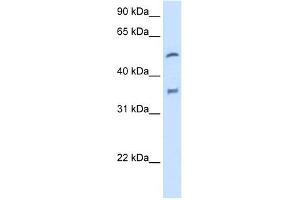WB Suggested Anti-CYP2D6 Antibody Titration:  2. (CYP2D6 抗体  (N-Term))