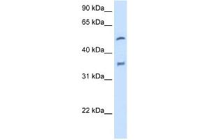 Western Blotting (WB) image for anti-Cytochrome P450, Family 2, Subfamily D, Polypeptide 6 (CYP2D6) (N-Term) antibody (ABIN2776931)
