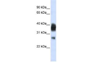RNASEH1 antibody used at 1 ug/ml to detect target protein. (Ribonuclease H1 抗体  (Middle Region))