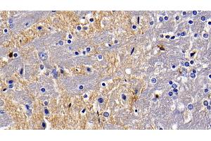 Detection of TLR5 in Rat Cerebrum Tissue using Polyclonal Antibody to Toll Like Receptor 5 (TLR5) (TLR5 抗体  (AA 325-644))