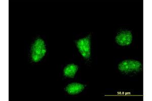 Immunofluorescence of monoclonal antibody to HAND2 on HeLa cell. (HAND2 抗体  (AA 135-216))