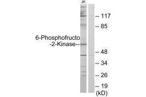 Western blot analysis of extracts from Jurkat cells, using PFKFB2 antibody. (PFKFB2 抗体  (N-Term))