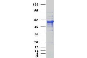 Validation with Western Blot (CD5 Protein (CD5) (Myc-DYKDDDDK Tag))