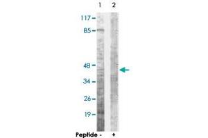 Western blot analysis of extracts from COS-7 cells, using OPRD1 polyclonal antibody . (OPRD1 抗体  (Ser363))