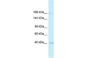 WB Suggested Anti-RGD1563533 Antibody   Titration: 1. (CASZ1 抗体  (Middle Region))