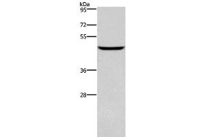 Western Blot analysis of Human testis tissue using DMRT3 Polyclonal Antibody at dilution of 1:550 (DMRT3 抗体)
