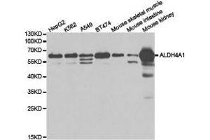 Western Blotting (WB) image for anti-Aldehyde Dehydrogenase 4 Family, Member A1 (ALDH4A1) antibody (ABIN1870929) (ALDH4A1 抗体)