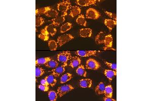 Immunofluorescence analysis of NIH-3T3 cells using  Rabbit pAb (ABIN7265423) at dilution of 1:100 (40x lens). (ACSL1 抗体  (AA 46-275))