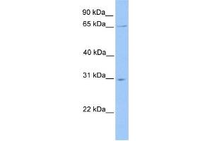 Western Blotting (WB) image for anti-Nuclear Receptor Subfamily 1, Group D, Member 2 (NR1D2) (N-Term) antibody (ABIN2780649)